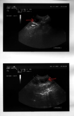 Das Ultraschallbild vom 17.12.2007